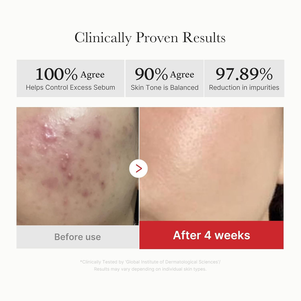 Toner Pads - 3-in-1 Targeted Skincare Formula For Clear Pores & Glass Glow Skin