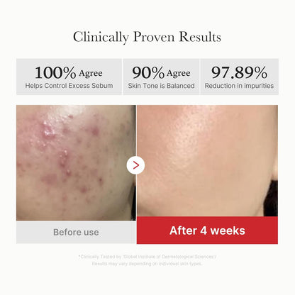 Toner Pads - 3-in-1 Targeted Skincare Formula For Clear Pores & Glass Glow Skin