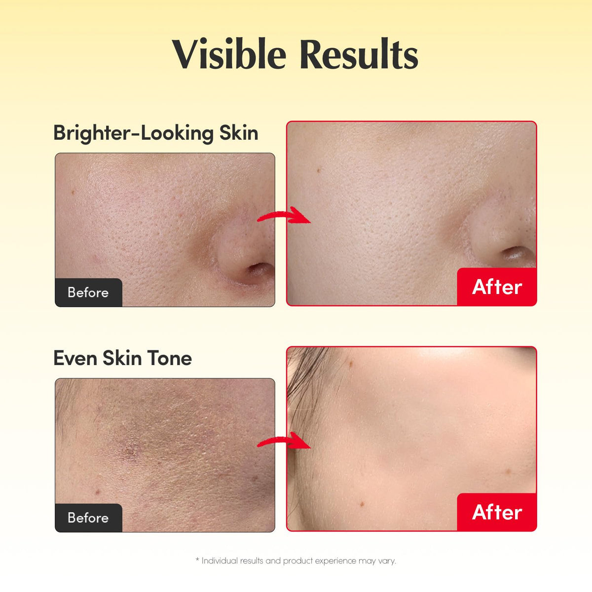 Vitamin Brightening Duo - Acerola + Niacinamide For A More Radiant, Even-Looking Glow